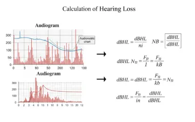 Calcul de la Perte Auditive à partir d’un Audiogramme